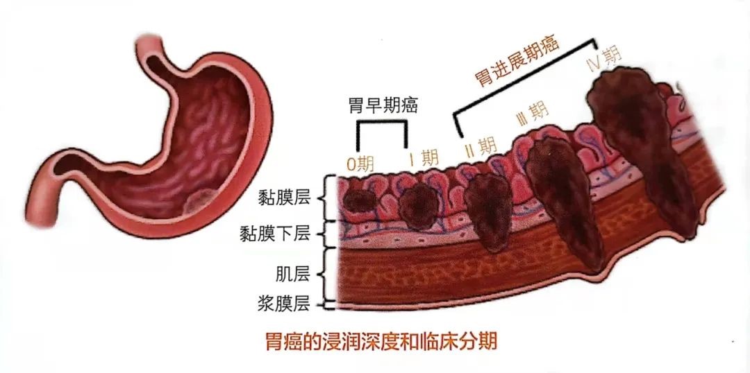 未设置